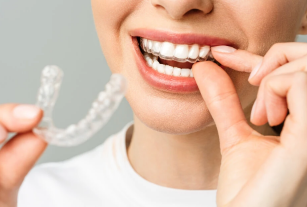Discreet Smile Correction: A Modern Path to Straighter Teeth